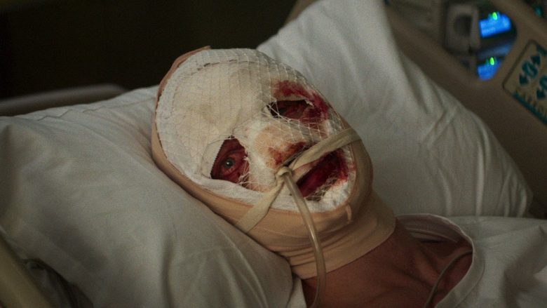 Cara-de-Barro, imagem 5